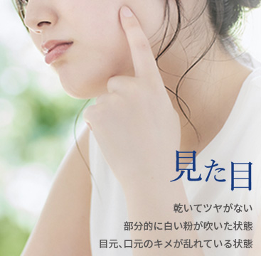 見た目／乾いてツヤがない・部分的に白い粉が吹いた状態・目元、口元のキメが乱れている状態