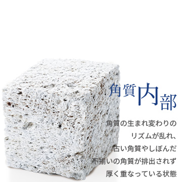 角質内部／角質の生まれ変わりのリズムが乱れ、古い角質やしぼんだ不揃いの角質が排出されず厚く重なっている状態