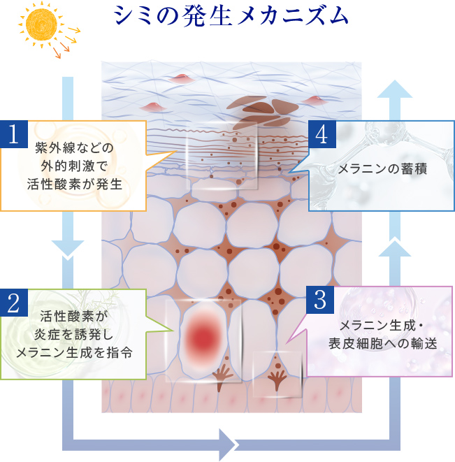 シミの発生メカニズム